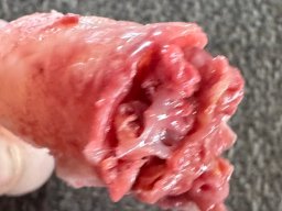 finger_03